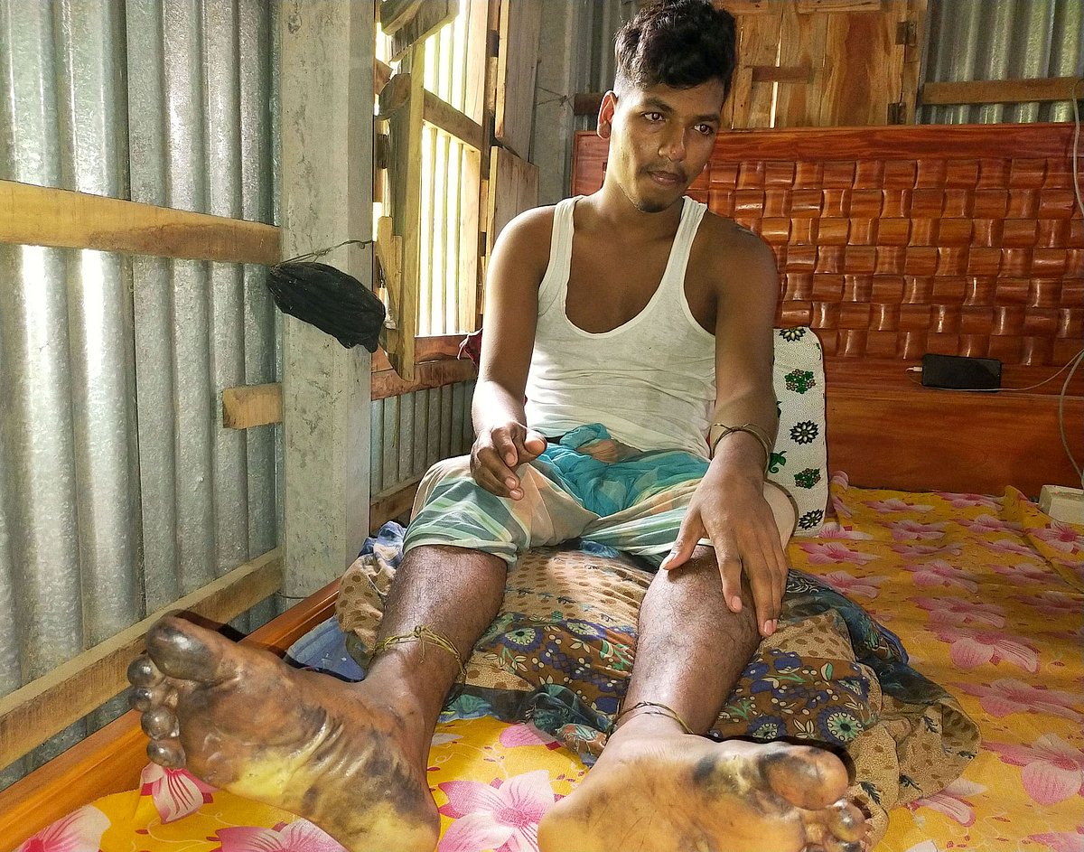 আহত ফয়সাল মণ্ডল